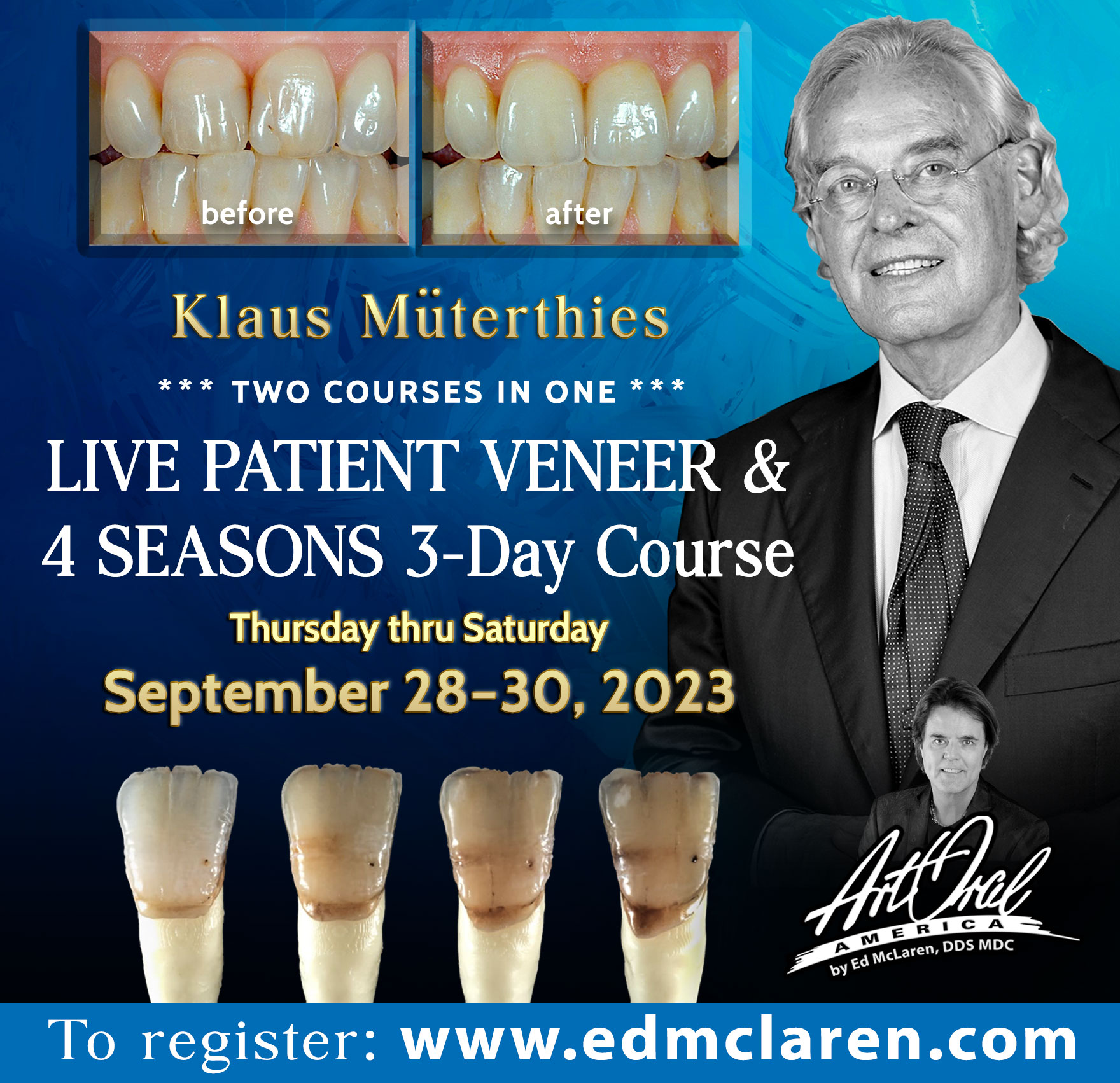 LIVE PATIENT Veneer and 4 Seasons Course (3 Day Course)
